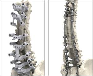Confronto del modello anatomico