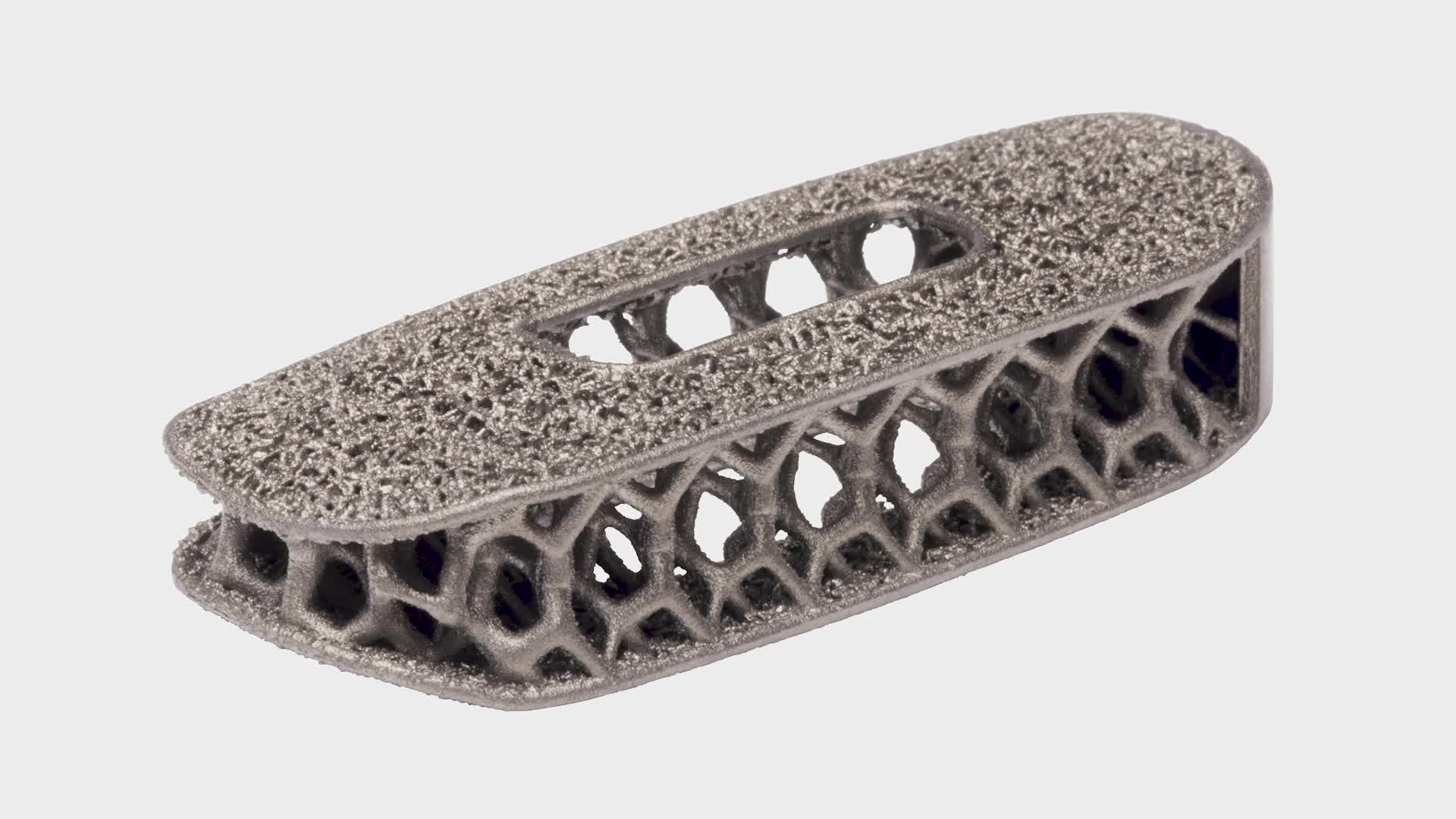 NuVasive Taps AM Ecosystem to Optimize Spine Implant Technology