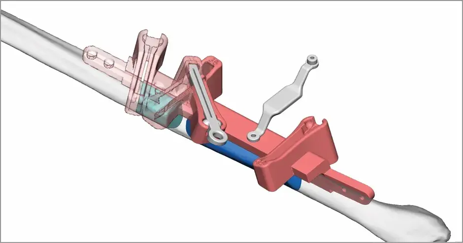 VSP - Pianificazione chirurgica virtuale