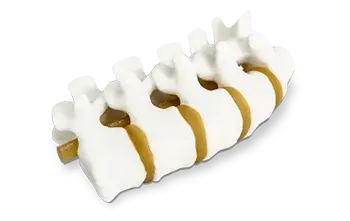 Modelli anatomici della colonna vertebrale stampati in 3D da 3D Systems