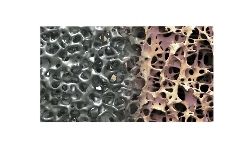 La linea Modulus di impianti spinali creata da NuVasive è stata progettata per migliorare gli esiti clinici per i pazienti che necessitano di un impianto spinale.