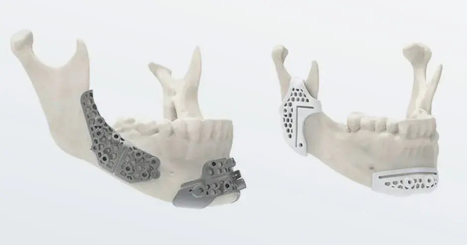 jaw materials