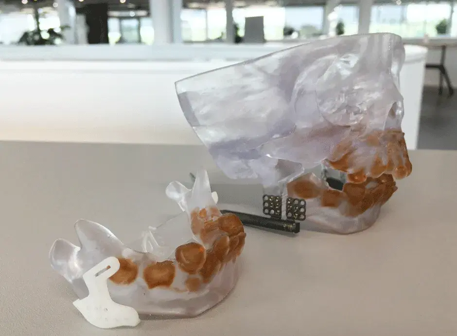 VSP Distraction anatomic models with guides