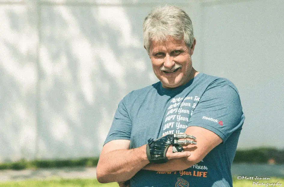 Jeff Soelberg indossa la sua protesi parziale della mano di Point Designs