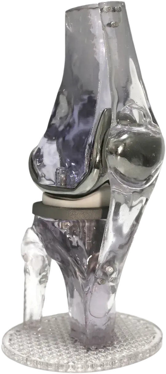 Ginocchio stampato in 3D