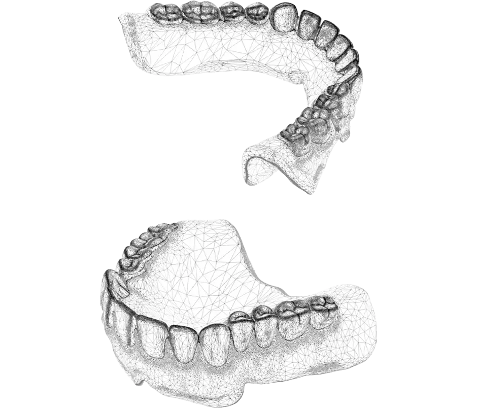 File CAD di produzione NextDent