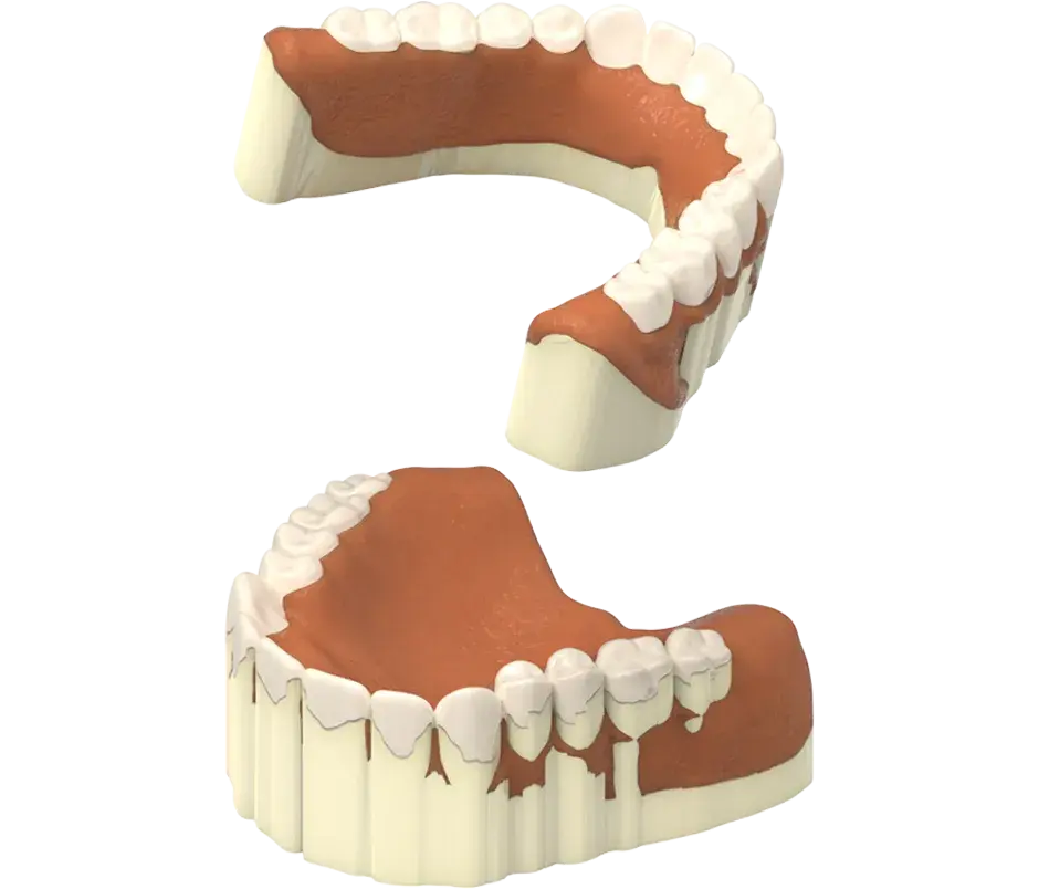 Rimozione del supporto della produzione NextDent