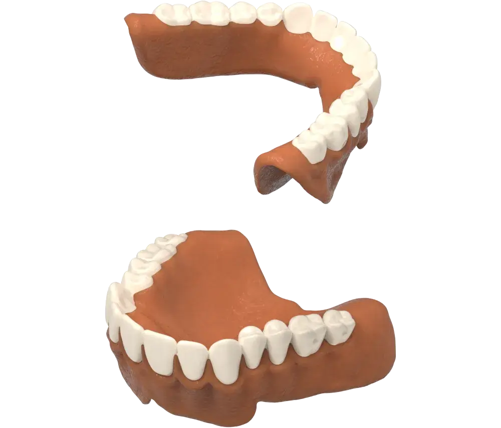 La cera di produzione NextDent è stata rimossa