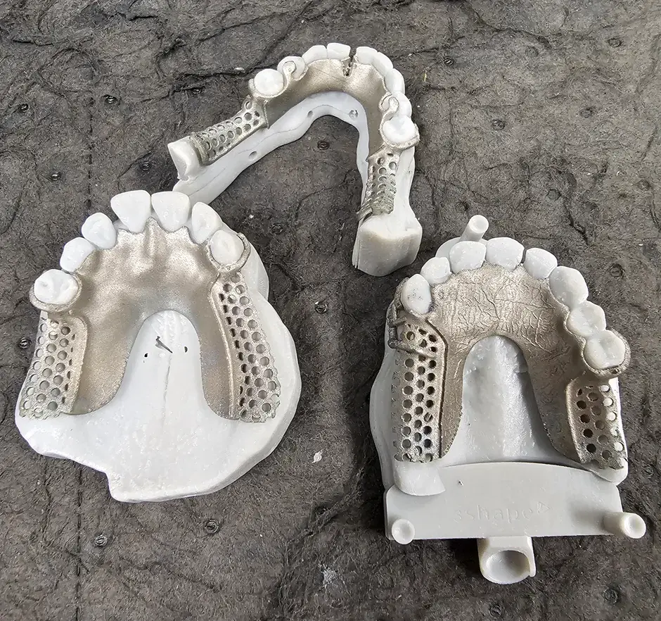 Parti odontoiatriche stampate in 3D