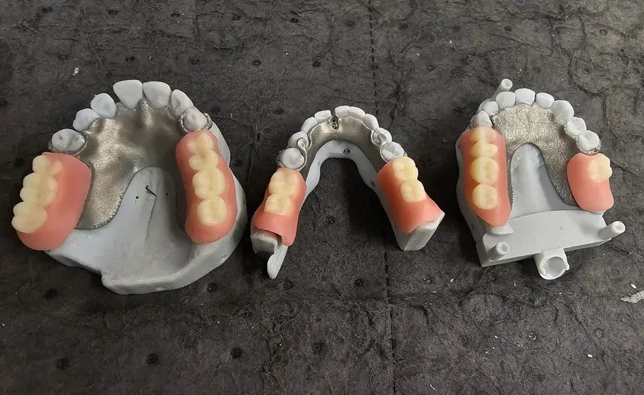 Parti odontoiatriche stampate in 3D
