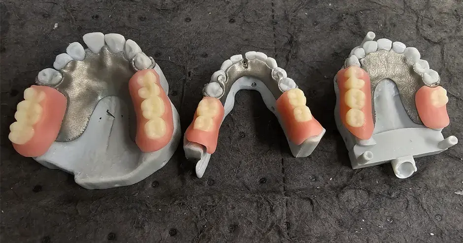 Protesi dentarie stampate in 3D