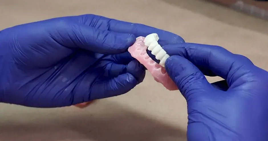 Dentista che tiene in mano protesi dentarie stampate in 3D