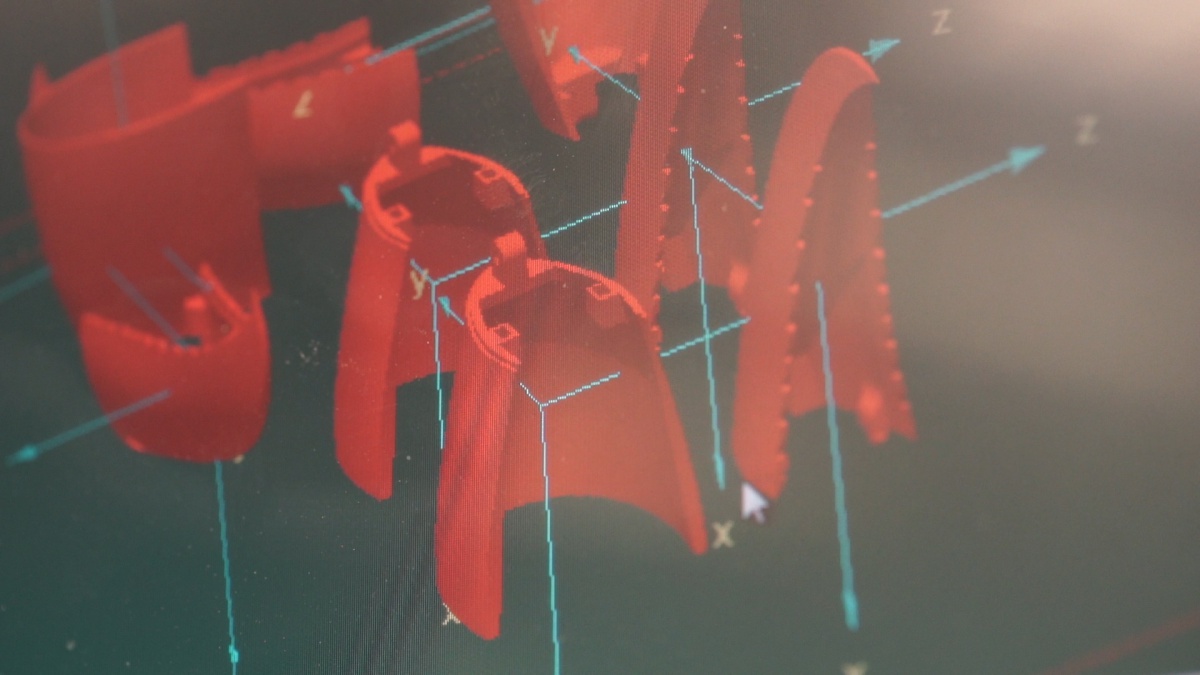 3D scanning and 3D design software were integral to restoring Grecia’s anatomy and autonomy